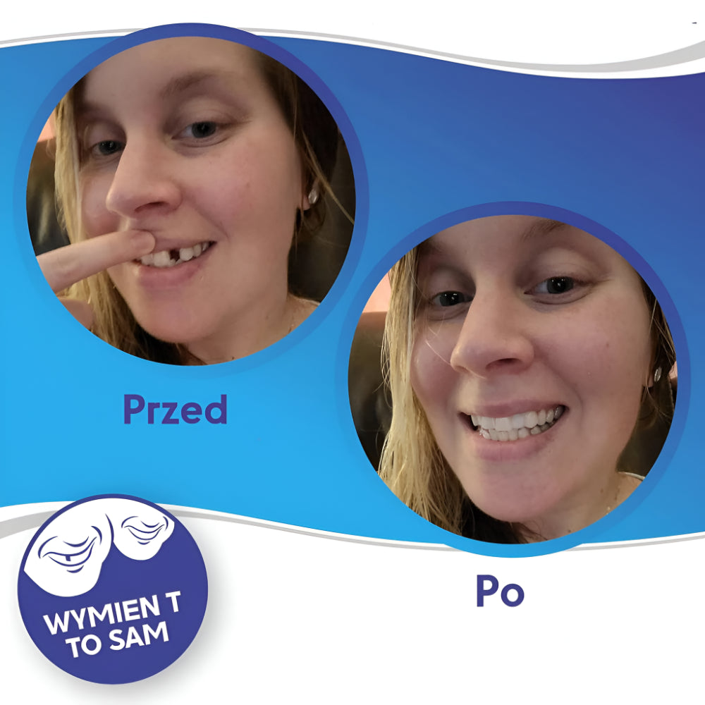 Licówki Nakładki na Zęby Silikonowe Estetyczne Uśmiech