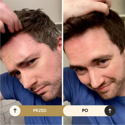 Włosów Szampon Koloryzujący Bez Amoniaku Koloryzacja