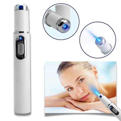 Laser do Skóry Przenośne Pióro do Usuwania Blizn i Przebarwień