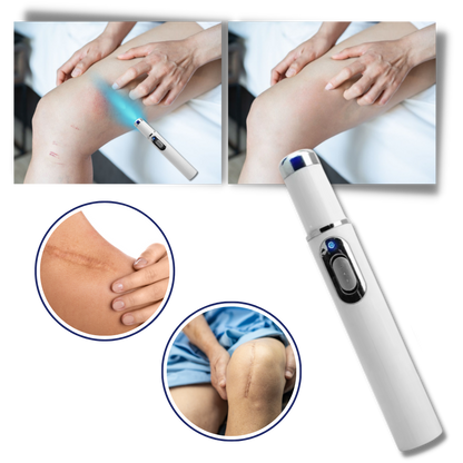 Laser do Skóry Przenośne Pióro do Usuwania Blizn i Przebarwień